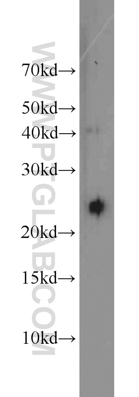 Western Blot (WB) analysis of mouse stomach tissue using GOSR2/Membrin Polyclonal antibody (12095-1-AP)