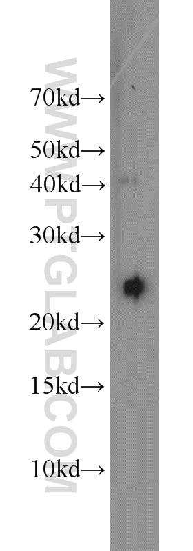 WB analysis of mouse stomach using 12095-1-AP