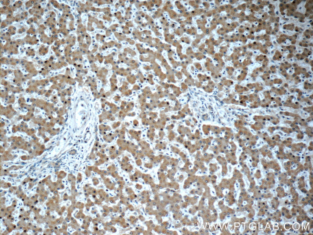 Immunohistochemistry (IHC) staining of human liver tissue using GOSR2/Membrin Monoclonal antibody (66134-1-Ig)