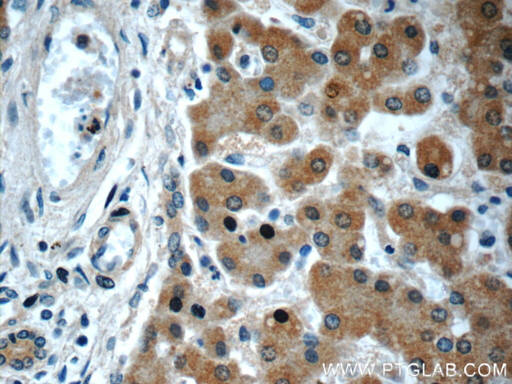 Immunohistochemistry (IHC) staining of human liver tissue using GOSR2/Membrin Monoclonal antibody (66134-1-Ig)