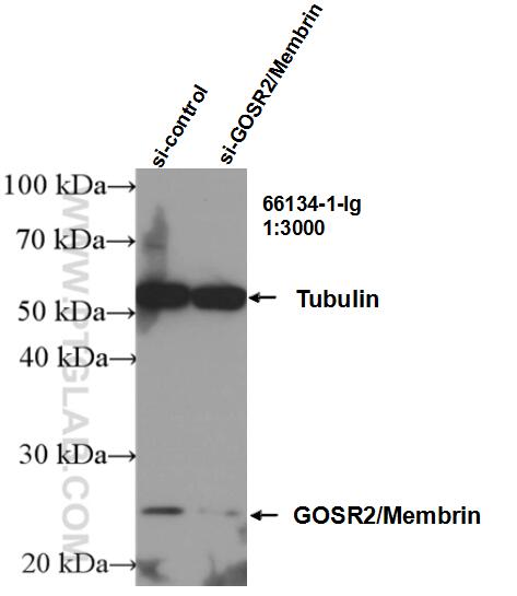 Western Blot (WB) analysis of Jurkat cells using GOSR2/Membrin Monoclonal antibody (66134-1-Ig)