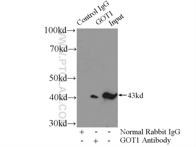 Immunoprecipitation (IP) experiment of mouse brain tissue using GOT1 Polyclonal antibody (14886-1-AP)