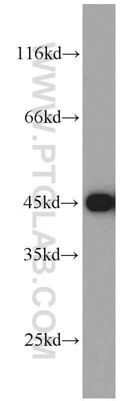 GOT1 Polyclonal antibody