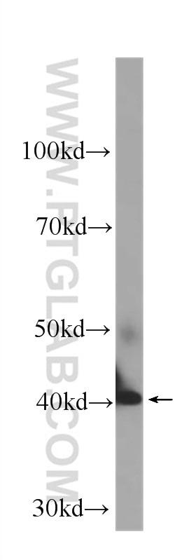 GOT1 Monoclonal antibody