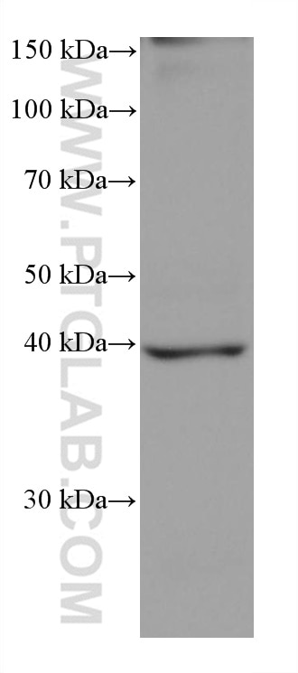 WB analysis of rat heart using 60317-1-Ig