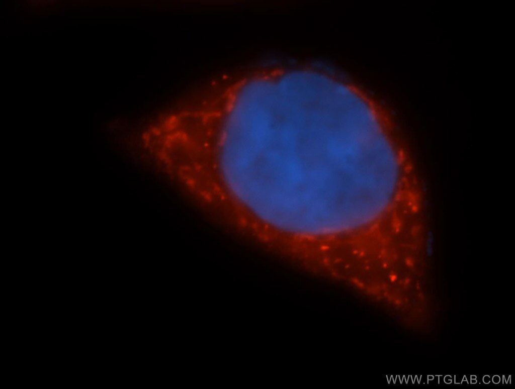 Immunofluorescence (IF) / fluorescent staining of MCF-7 cells using GOT2 Polyclonal antibody (14800-1-AP)