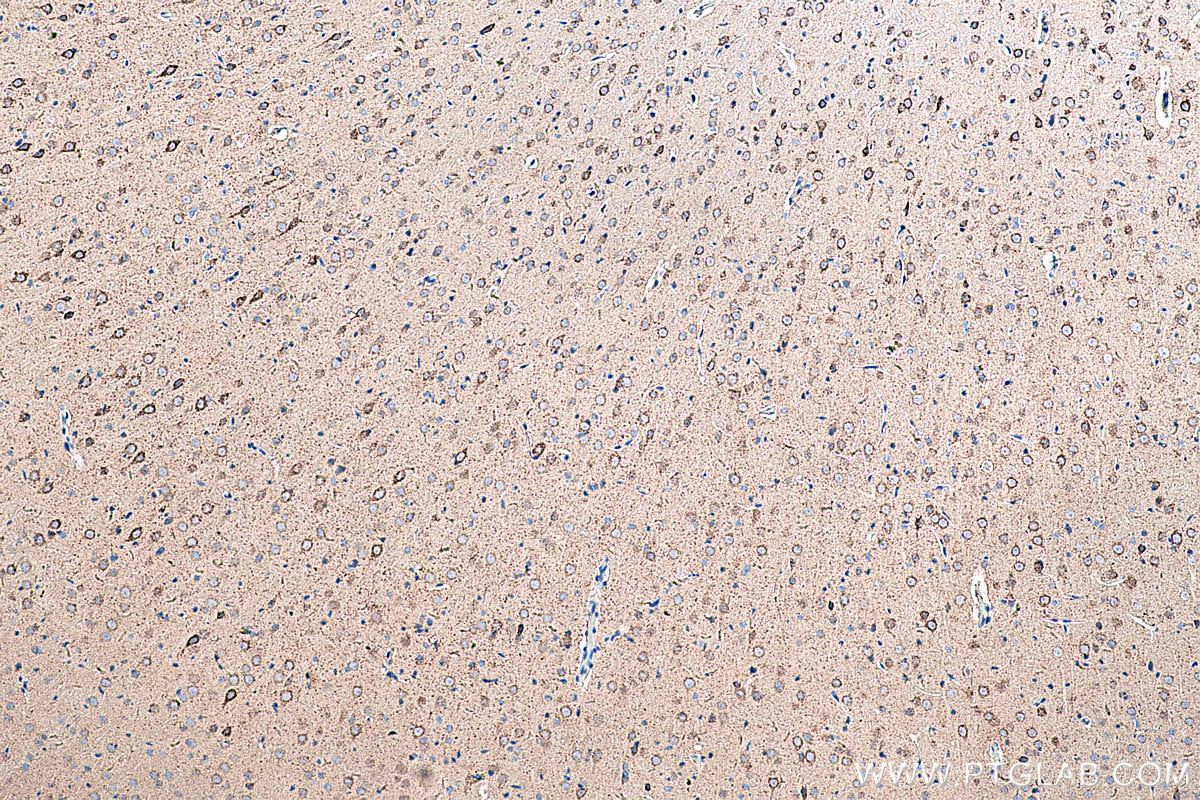 Immunohistochemistry (IHC) staining of rat brain tissue using GOT2 Polyclonal antibody (14800-1-AP)