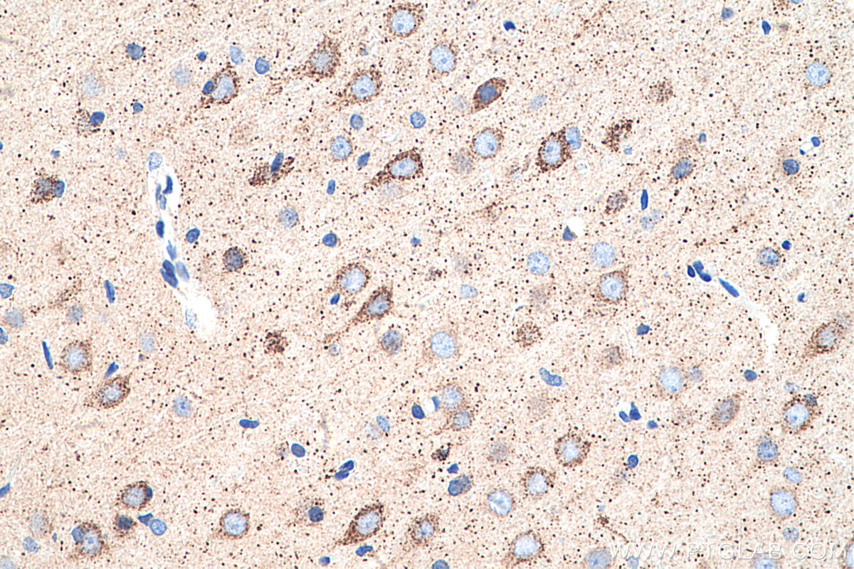 Immunohistochemistry (IHC) staining of rat brain tissue using GOT2 Polyclonal antibody (14800-1-AP)