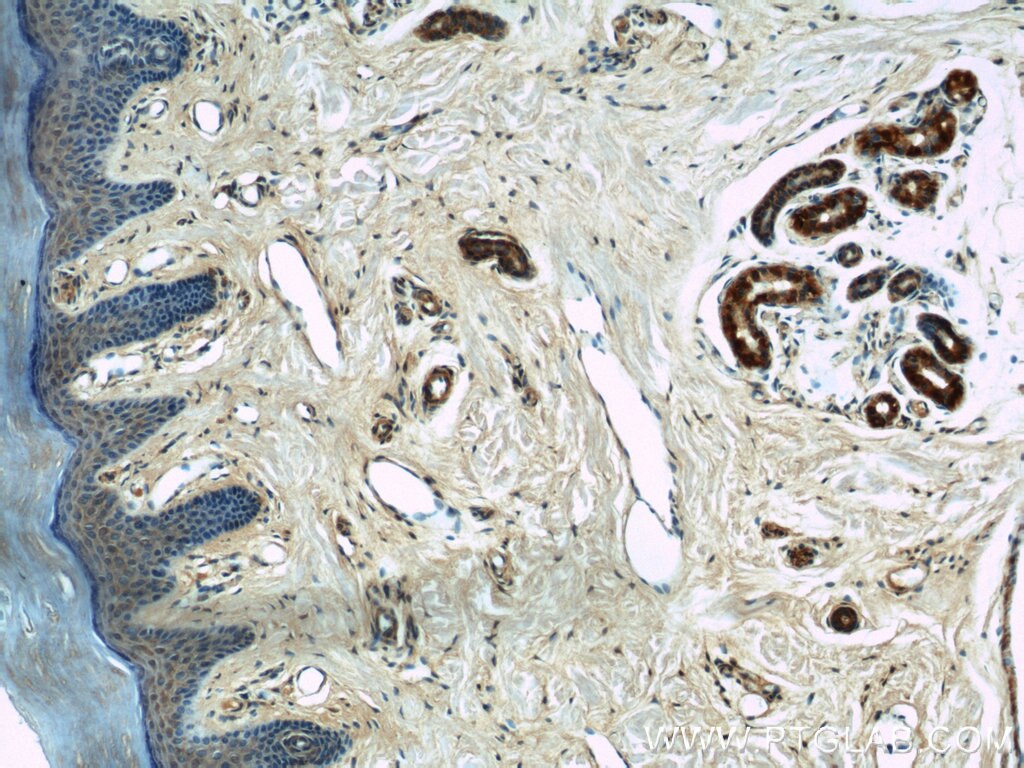 IHC staining of human skin using 14800-1-AP