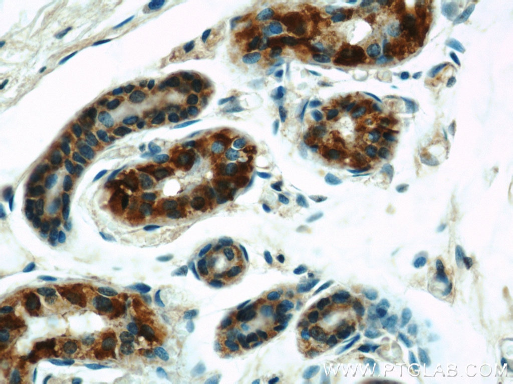 Immunohistochemistry (IHC) staining of human skin tissue using GOT2 Polyclonal antibody (14800-1-AP)