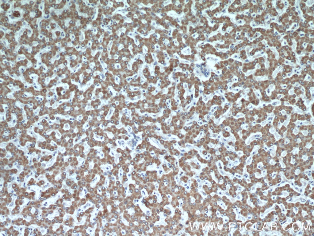 Immunohistochemistry (IHC) staining of human liver tissue using GOT2 Polyclonal antibody (14800-1-AP)