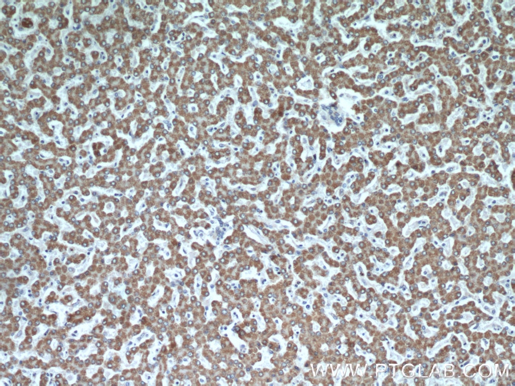 IHC staining of human liver using 14800-1-AP