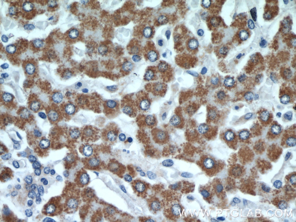 Immunohistochemistry (IHC) staining of human liver tissue using GOT2 Polyclonal antibody (14800-1-AP)