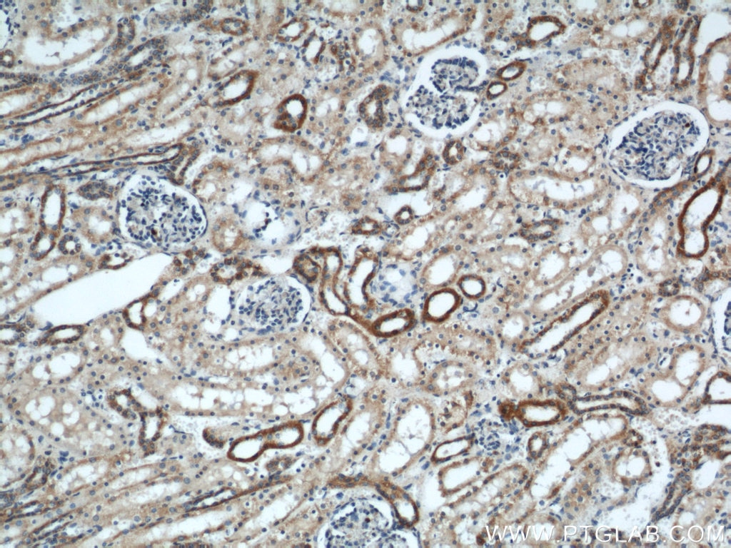 IHC staining of human kidney using 14800-1-AP