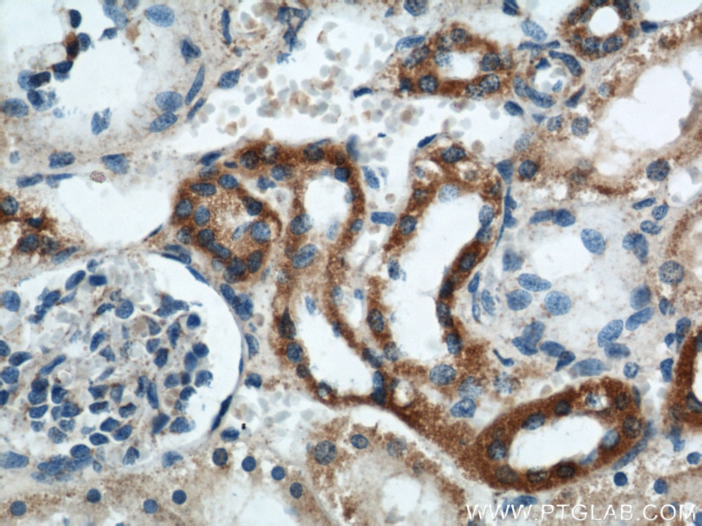Immunohistochemistry (IHC) staining of human kidney tissue using GOT2 Polyclonal antibody (14800-1-AP)
