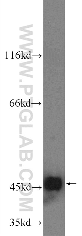 Western Blot (WB) analysis of rat brain tissue using GOT2 Polyclonal antibody (14800-1-AP)