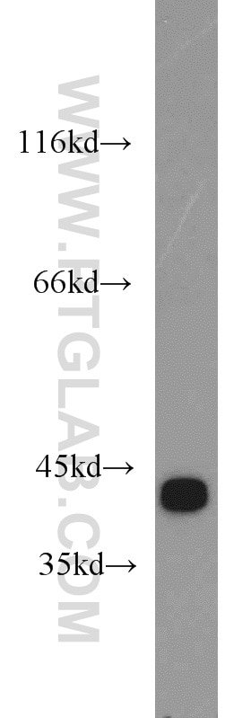 GOT2 Polyclonal antibody