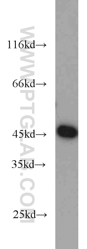 Western Blot (WB) analysis of A431 cells using GOT2 Polyclonal antibody (14800-1-AP)