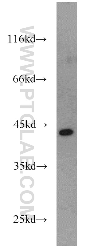 Western Blot (WB) analysis of HepG2 cells using GOT2 Polyclonal antibody (14800-1-AP)