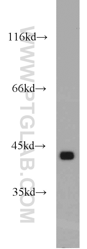 Western Blot (WB) analysis of mouse spleen tissue using GOT2 Polyclonal antibody (14800-1-AP)