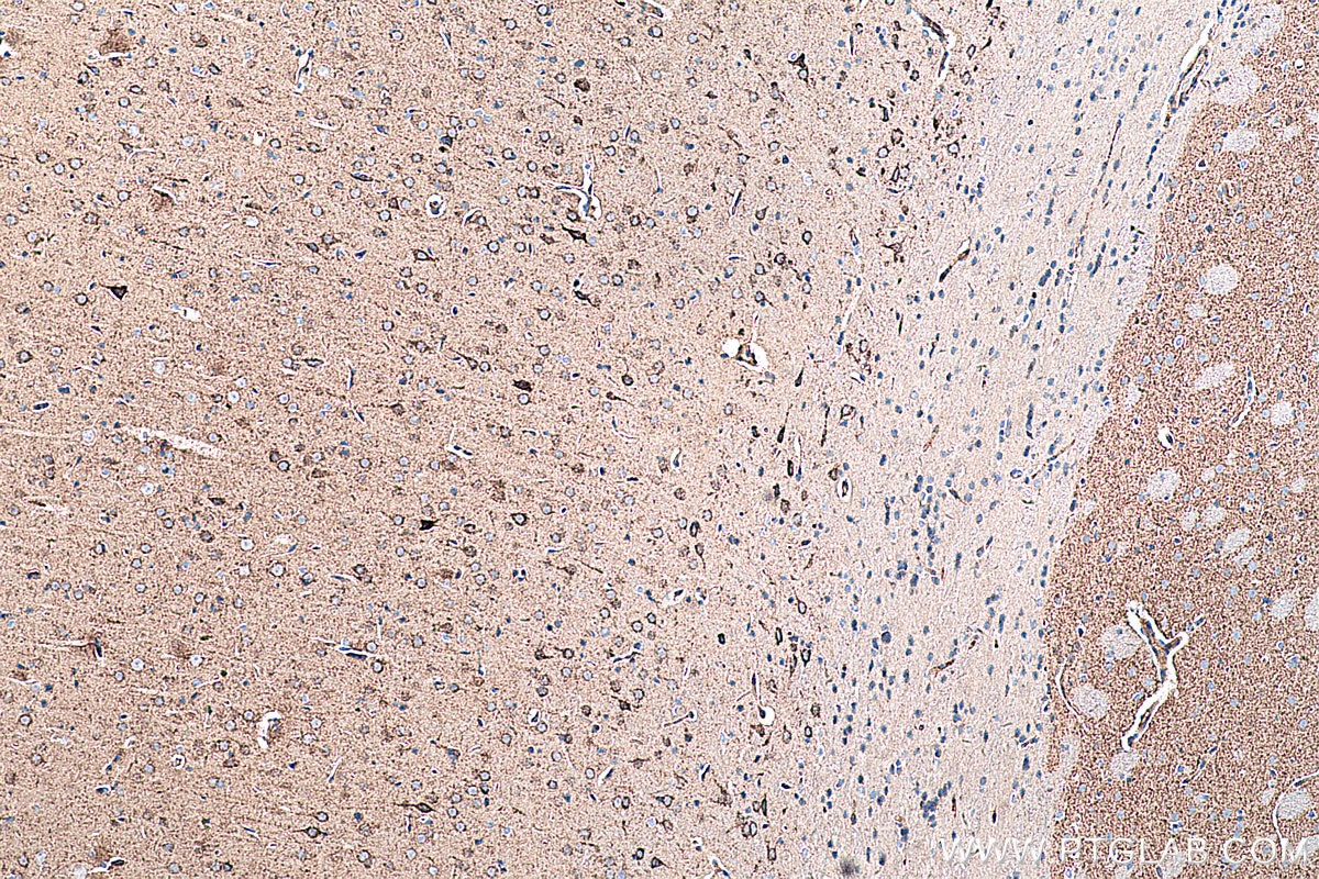 Immunohistochemistry (IHC) staining of rat brain tissue using GOT2 Monoclonal antibody (67738-1-Ig)