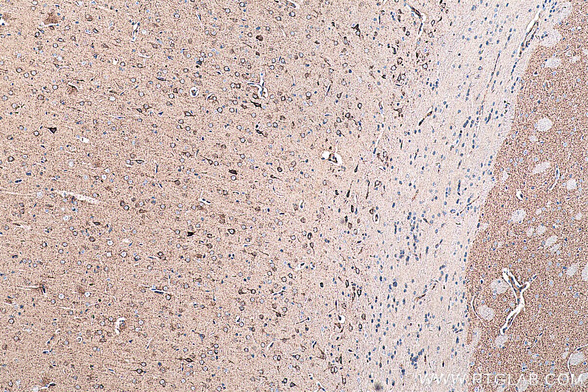 Immunohistochemistry (IHC) staining of rat brain tissue using GOT2 Monoclonal antibody (67738-1-Ig)