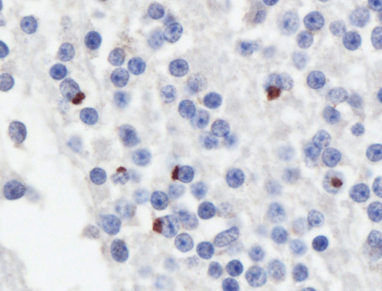 Immunohistochemistry (IHC) staining of human cerebellum tissue using GP repeat Polyclonal antibody (24494-1-AP)