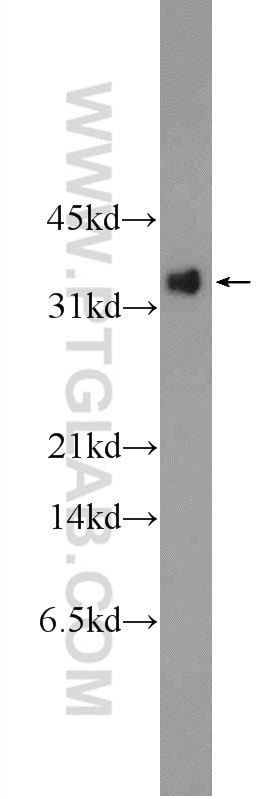 GP repeat Polyclonal antibody