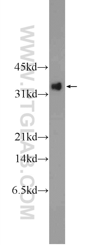 WB analysis of Recombinant protein using 24494-1-AP