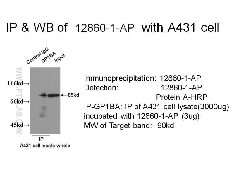 CD42b