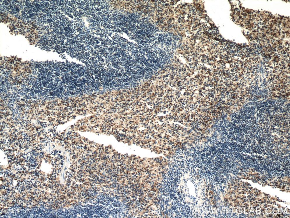 Immunohistochemistry (IHC) staining of mouse spleen tissue using CD42b Polyclonal antibody (12860-1-AP)