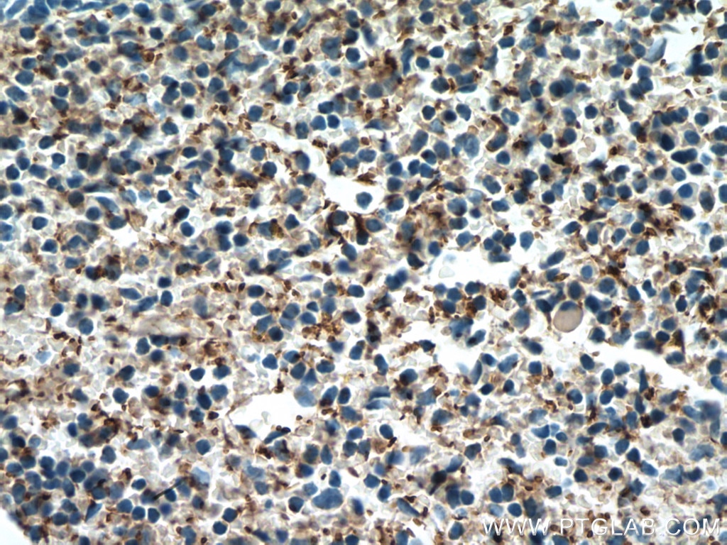 IHC staining of mouse spleen using 12860-1-AP