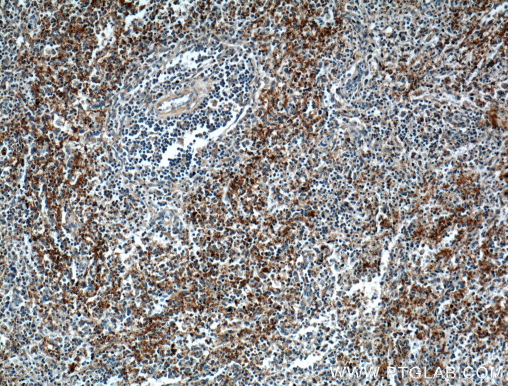 Immunohistochemistry (IHC) staining of human spleen tissue using CD42b Polyclonal antibody (12860-1-AP)