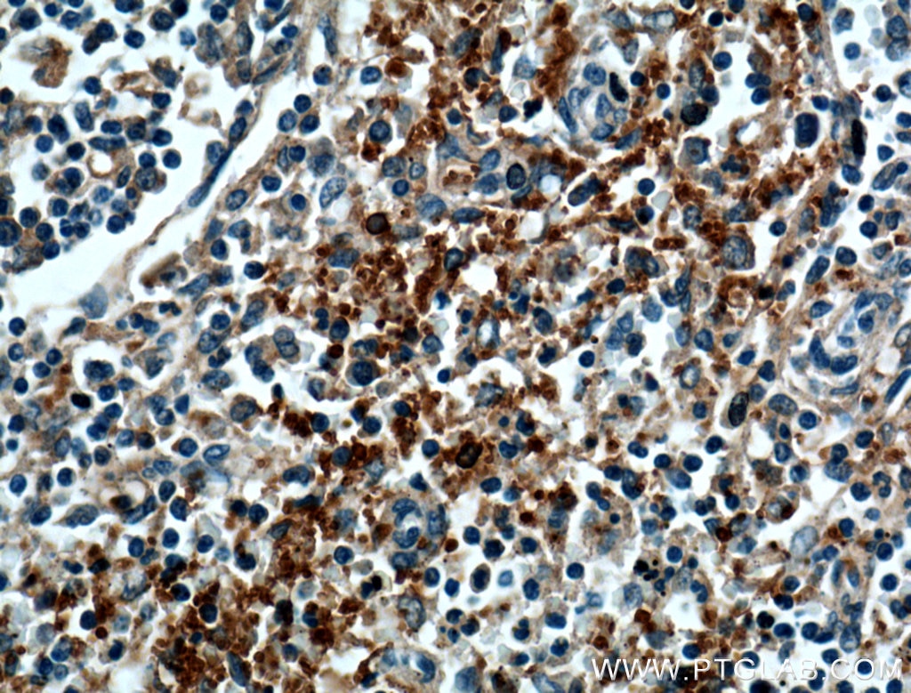 Immunohistochemistry (IHC) staining of human spleen tissue using CD42b Polyclonal antibody (12860-1-AP)