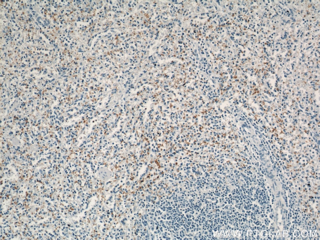 Immunohistochemistry (IHC) staining of human spleen tissue using CD42b Polyclonal antibody (12860-1-AP)