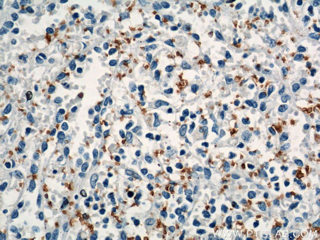 IHC staining of human spleen using 12860-1-AP