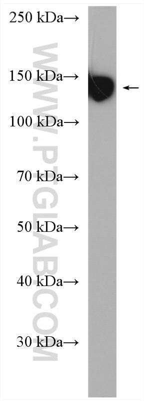 Western Blot (WB) analysis of human peripheral blood platelets using CD42b Polyclonal antibody (12860-1-AP)