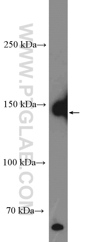 Western Blot (WB) analysis of pig peripheral blood leukocyte using CD42b Polyclonal antibody (12860-1-AP)
