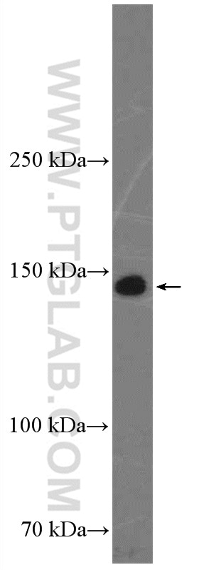 Western Blot (WB) analysis of human blood using CD42b Polyclonal antibody (12860-1-AP)