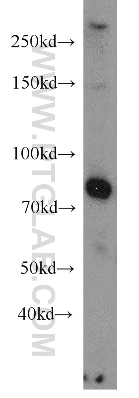 CD42b Polyclonal antibody