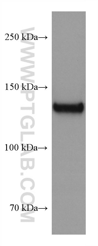 Western Blot (WB) analysis of human blood using CD42b Monoclonal antibody (67857-1-Ig)