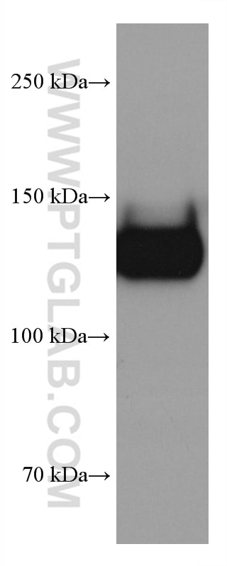 Western Blot (WB) analysis of human peripheral blood platelets using CD42b Monoclonal antibody (67857-1-Ig)