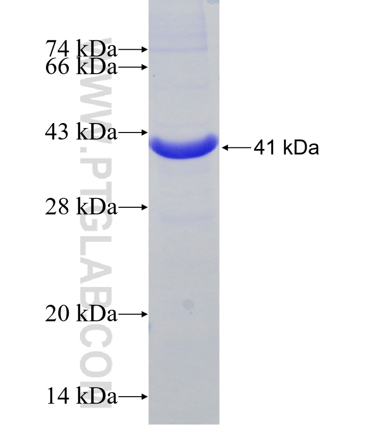 GP1BA fusion protein Ag31181 SDS-PAGE