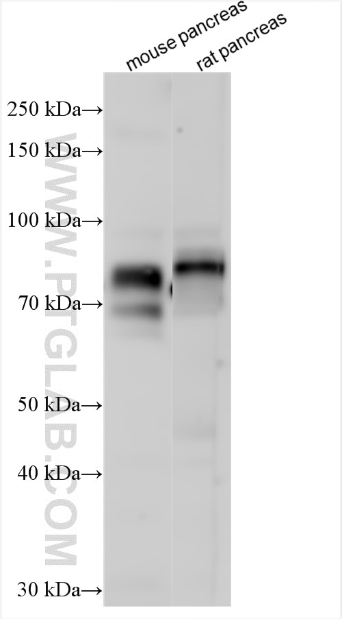 Western Blot (WB) analysis of various lysates using GP2 Polyclonal antibody (13493-1-AP)