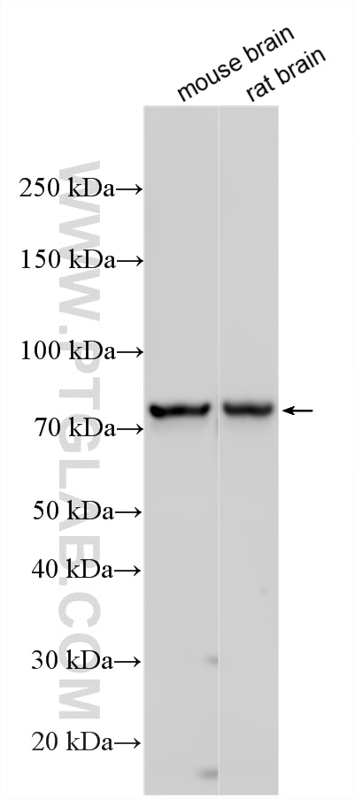 Western Blot (WB) analysis of various lysates using GP2 Polyclonal antibody (13493-1-AP)