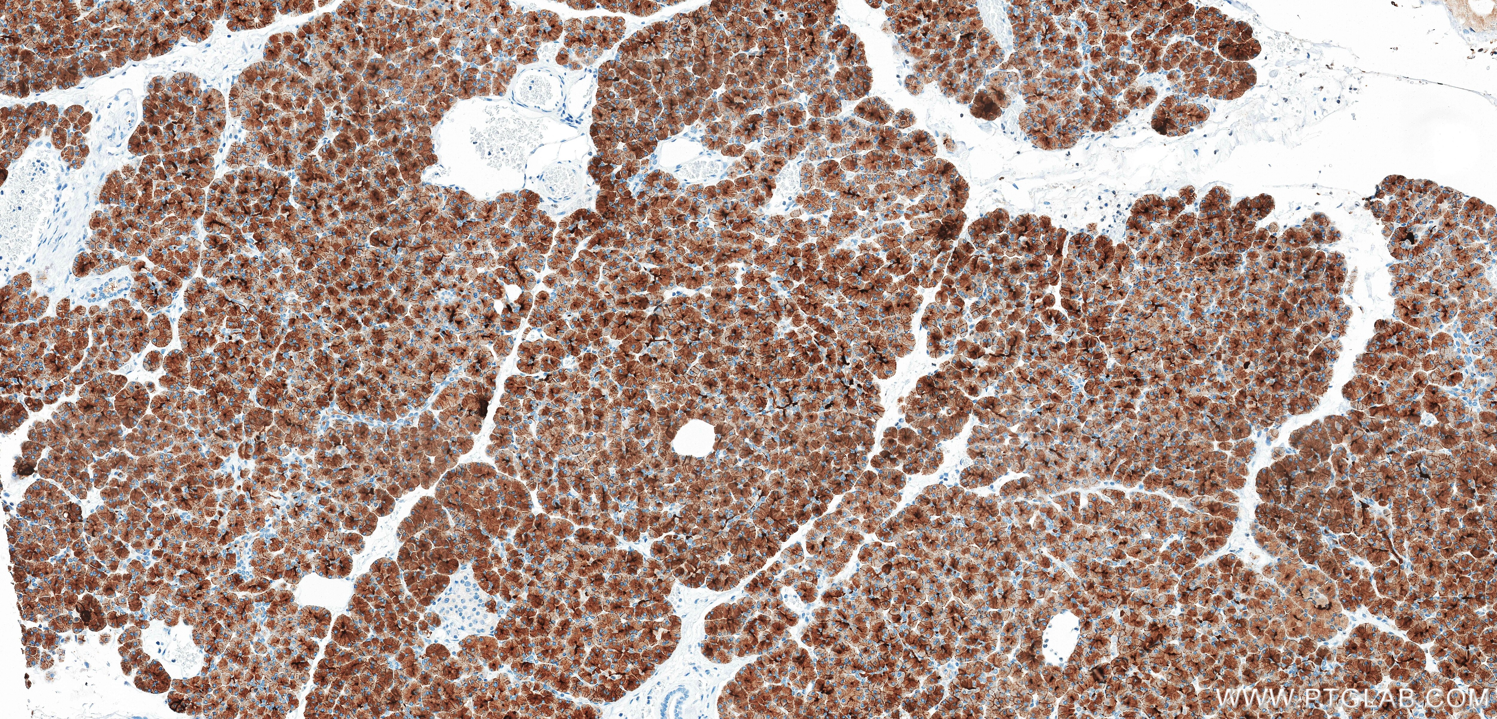 Immunohistochemistry (IHC) staining of human pancreas tissue using GP2 Recombinant monoclonal antibody (84728-4-RR)