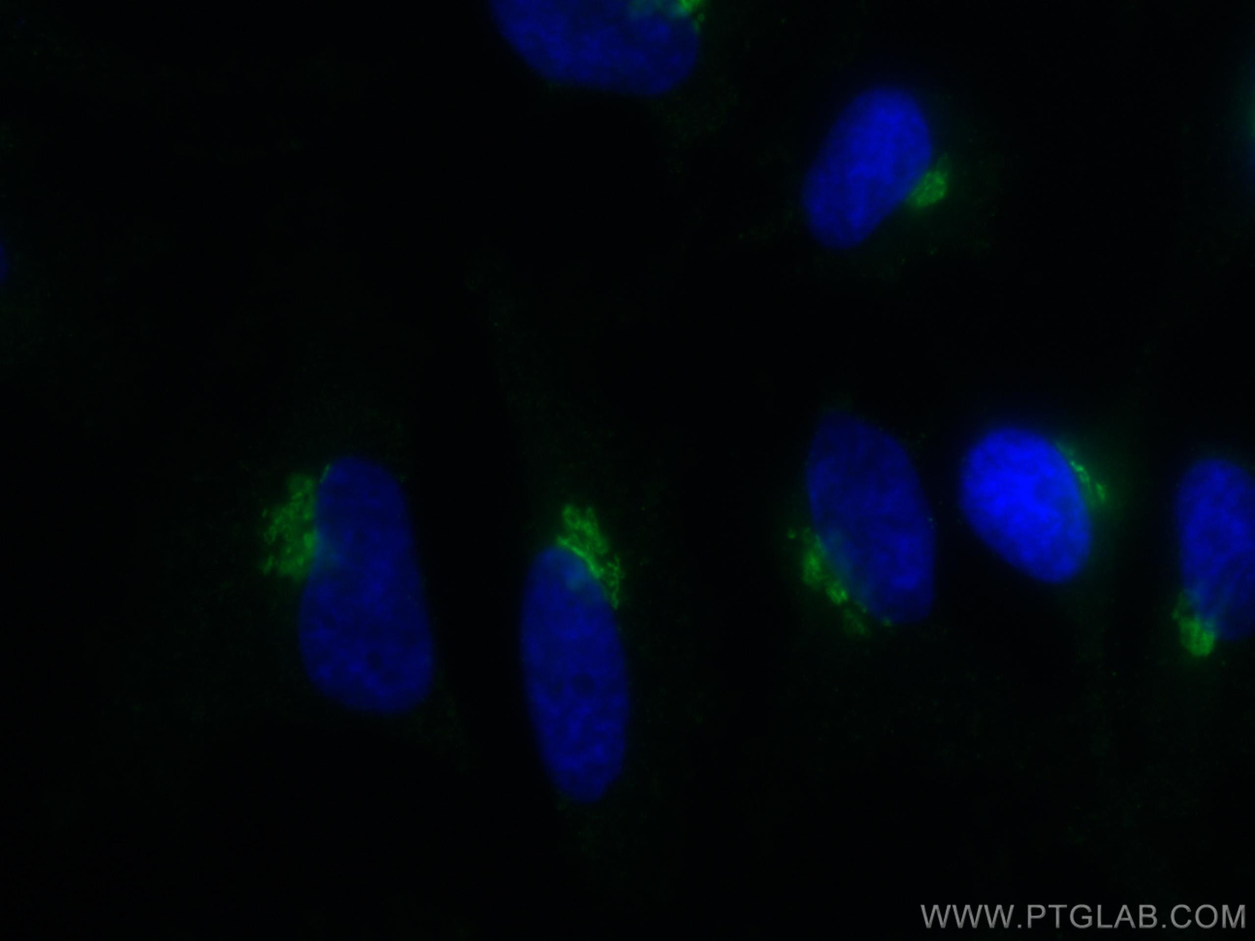 Immunofluorescence (IF) / fluorescent staining of HeLa cells using GP73/GOLPH2 Monoclonal antibody (66331-1-Ig)