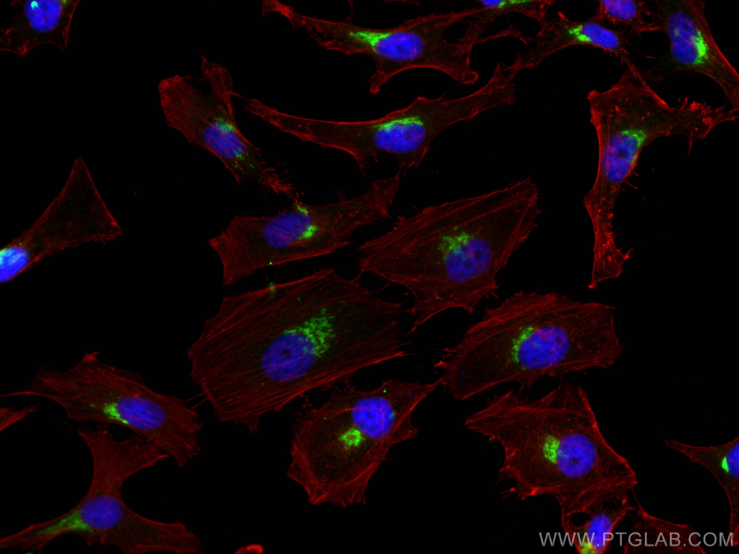 Immunofluorescence (IF) / fluorescent staining of HeLa cells using GP73/GOLPH2 Monoclonal antibody (66331-1-Ig)