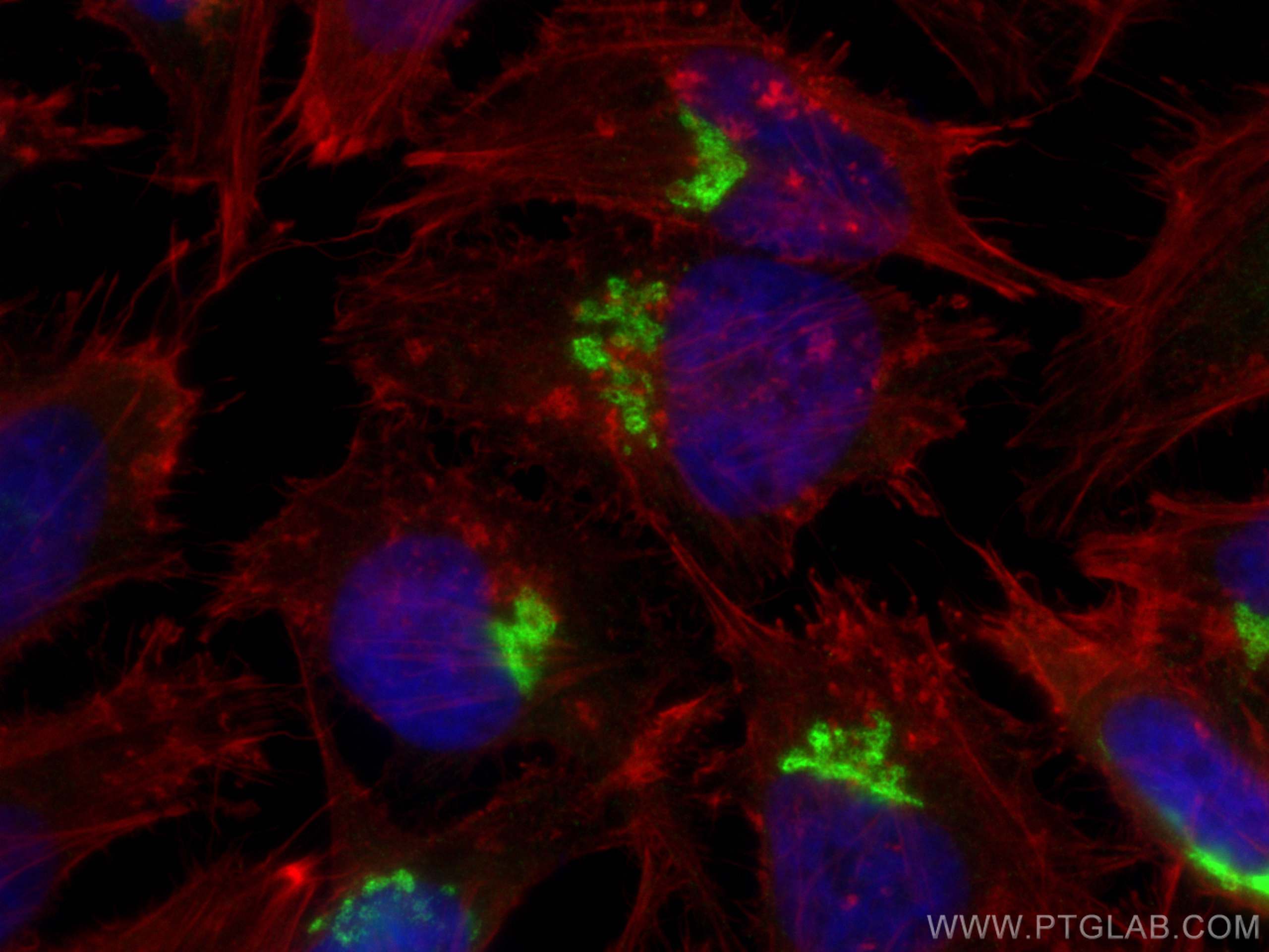 IF Staining of HeLa using 81893-1-RR