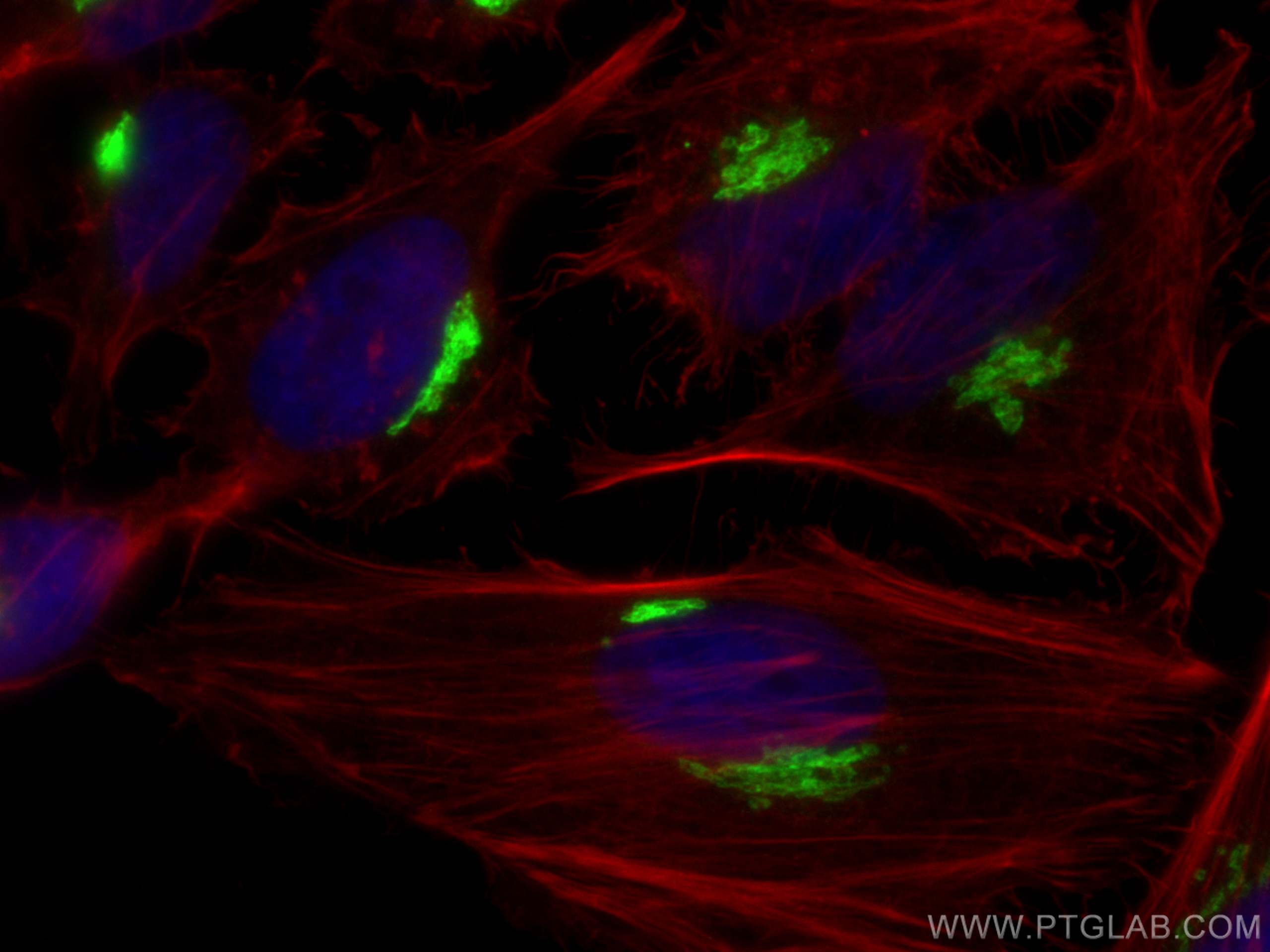 Immunofluorescence (IF) / fluorescent staining of HeLa cells using GP73/GOLPH2 Recombinant antibody (81893-1-RR)